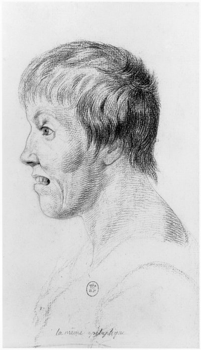 Epileptic Woman, Profile, Illustration from an Unpublished Treatise by Jean Etienne Dominique Esquirol (1772-1840) on the Lunatics of the Salpetriere Asylum, c.1818 by Georges Francois Gabriel